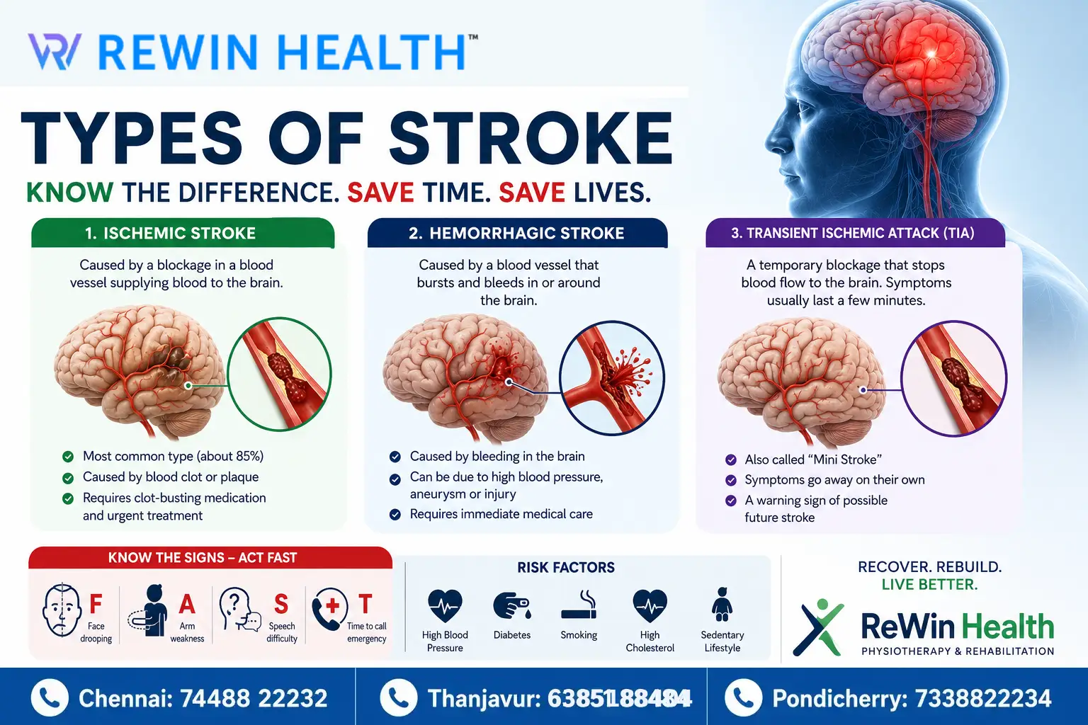 Types of Stroke: Everything You Need to Know About Stroke and Recovery