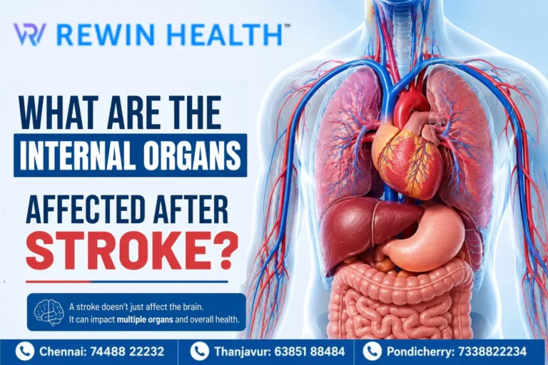 What Internal Organs Can Be Affected After a Stroke?